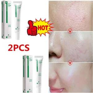 2PCS-Salicylic-Acid-Shrink-Pores-Cream-Products-Oil-Control-Moisturizing-Smooth-Skin-Care-Nourish-Fade-Acne