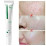 2PCS-Salicylic-Acid-Shrink-Pores-Cream-Products-Oil-Control-Moisturizing-Smooth-Skin-Care-Nourish-Fade-Acne-4