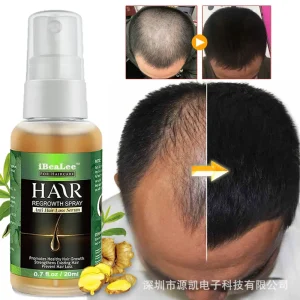 5-pcs-Ginger-Hair-Growth-Product-Anti-loss-Hair-Regrowth-Serum-Oil-Fast-Grow-Prevent-Baldness-1