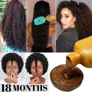 Black-Anti-hair-Loss-Products-Hair-Care-Rapid-Hair-Growth-After-Delivery-Seborrheic-Alopecia-Anti-dandruff