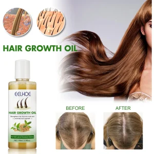 Dense-Hair-Care-Oil-Fast-Growing-Hair-Moisturizes-Strengthens-Solid-Nourishes-Scalp-Thick-Hair-Care-Reduce-1