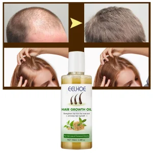 Dense-Hair-Care-Oil-Fast-Growing-Hair-Moisturizes-Strengthens-Solid-Nourishes-Scalp-Thick-Hair-Care-Reduce