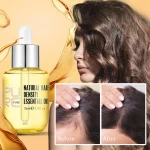 Hair-Growth-Serum-Ginger-Extract-Prevent-Hair-Loss-Oil-Scalp-Treatments-Fast-Growing-Hair-Care-Products-3