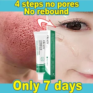Instan-Shrink-Pores-Cream-Powerful-Blackhead-Removal-Acne-Treatment-Scar-Removal-Oil-Control-Anti-Aging-Skincare