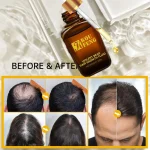 KouFeng-Hair-Growth-Essential-Oil-Natural-Anti-Hair-Loss-Products-Fast-Grow-Prevent-Baldness-Treatment-Germinal-2