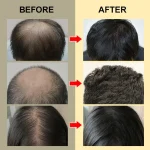 KouFeng-Hair-Growth-Essential-Oil-Natural-Anti-Hair-Loss-Products-Fast-Grow-Prevent-Baldness-Treatment-Germinal-3