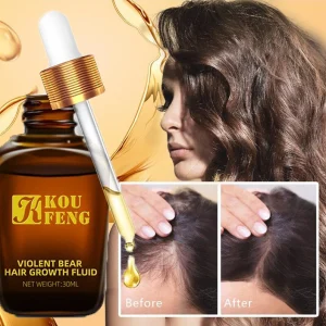 KouFeng-Hair-Growth-Essential-Oil-Natural-Anti-Hair-Loss-Products-Fast-Grow-Prevent-Baldness-Treatment-Germinal
