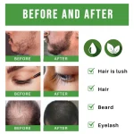 Rosemary-Hair-Growth-Oil-Fast-Growing-Anti-Hair-Loss-Essential-Oil-Repair-Damage-Baldness-Scalp-Hair-4