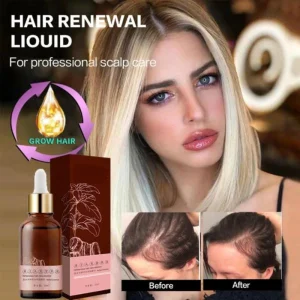 New-Anti-Hair-Loss-Fast-Hair-Growth-Essential-Oil-for-Men-Women-Dry-Hair-Essence-Regeneration-1