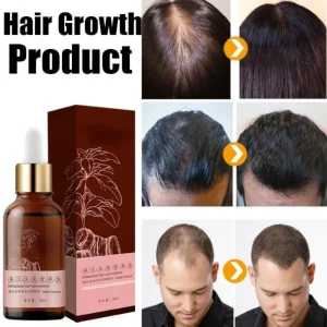 New-Anti-Hair-Loss-Fast-Hair-Growth-Essential-Oil-for-Men-Women-Dry-Hair-Essence-Regeneration