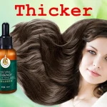 Brand-new-Hair-Growth-Serum-30-20-10ml-Anti-Preventing-Hair-Loss-Alopecia-Liquid-Damaged-Hair-3