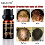 CZLMI-10ML-Keratin-Treatment-Hair-Loss-Products-Natural-with-No-Side-Effects-Grow-Hair-Faster-Regrowth-3