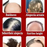 Hair-growth-oil-effective-baldness-repair-hereditary-hair-loss-postpartum-hair-loss-2