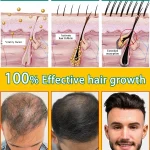 Hair-growth-oil-effective-baldness-repair-hereditary-hair-loss-postpartum-hair-loss-3