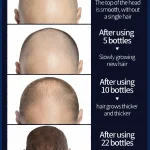 Hair-growth-oil-effective-baldness-repair-hereditary-hair-loss-postpartum-hair-loss-5
