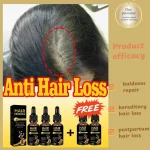 Hair-growth-oil-effective-baldness-repair-hereditary-hair-loss-postpartum-hair-loss