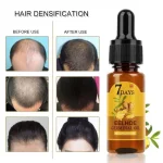 NEW-Effective-Hair-Loss-Treatment-Conditioner-Natural-Ginger-Plant-Oil-Fast-growing-Hair-Repair-Care-Cosmetics-3