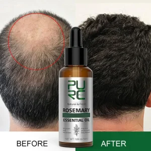 Rosemary-Oil-Essential-Oils-Ginger-Anti-Hair-Loss-Scalp-Treatment-Hair-Care-Fast-Growing-Products-For-1